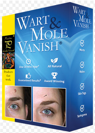 wart vanish syringoma warts pelangsing obat moles